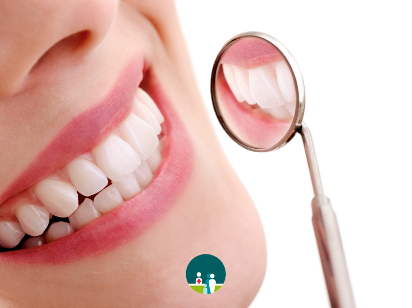 Come salvaguardare un bel sorriso